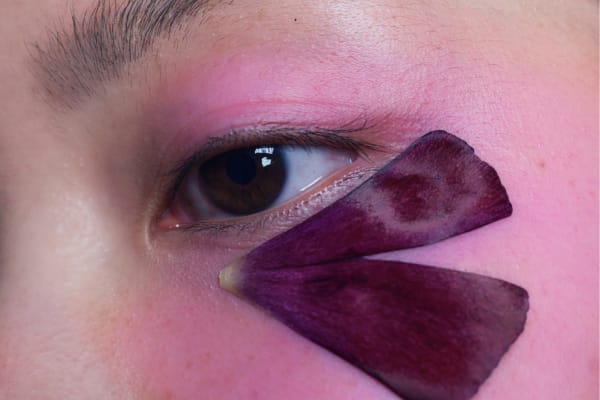 NMN