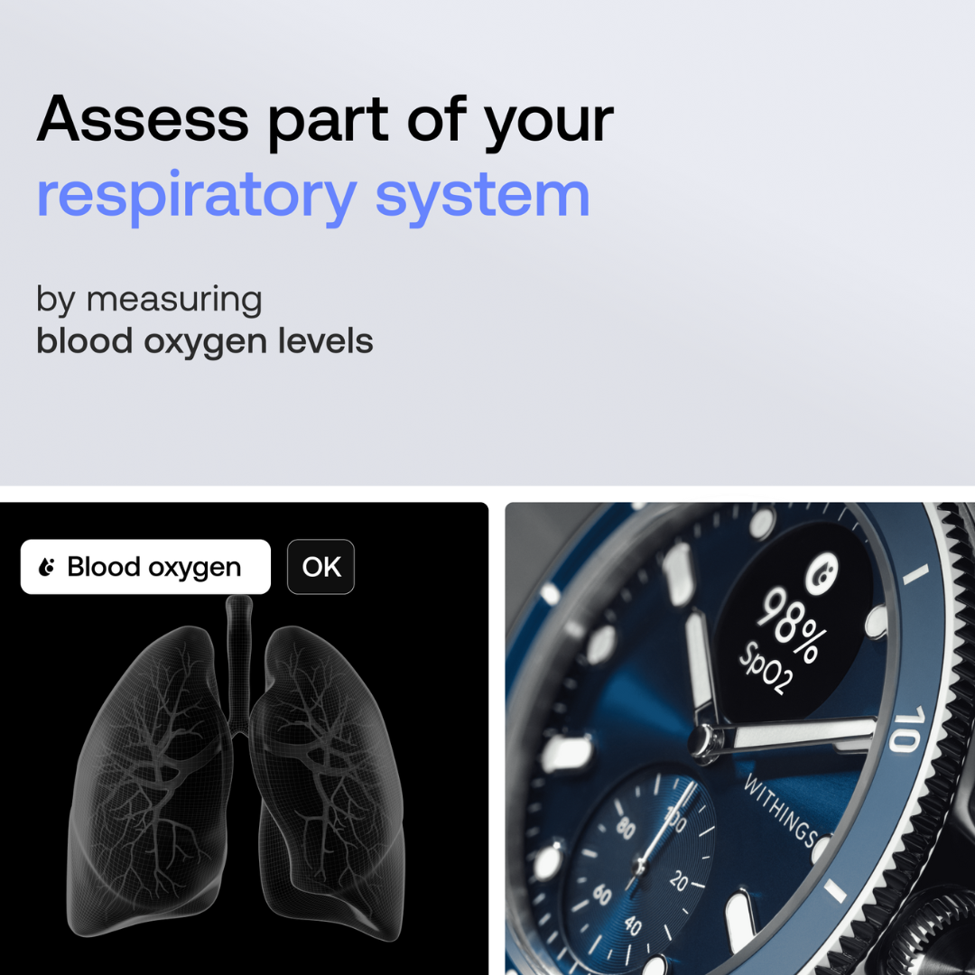 ScanWatch Nova - Blue - Image 4