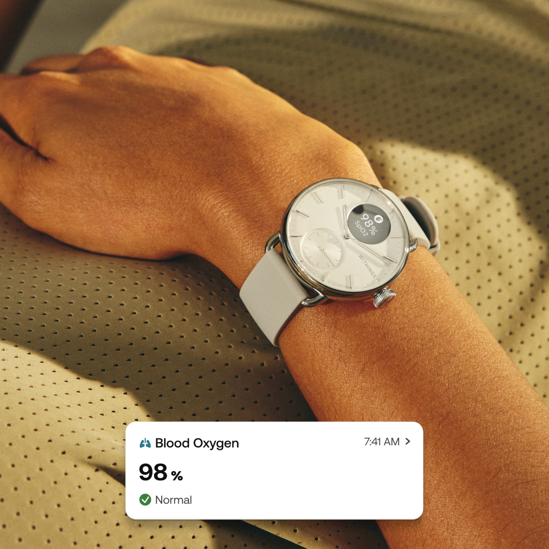 ScanWatch 2 - 38mm - Image 7